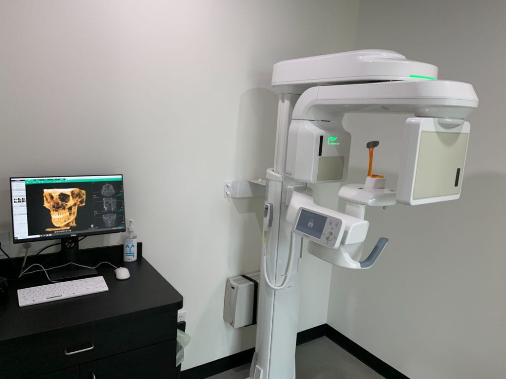 CBCT Machine