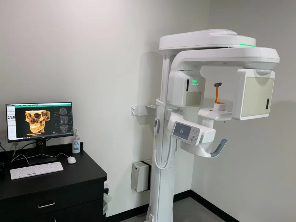 CBCT 3D X-rays Orthodontics, X-ray machine