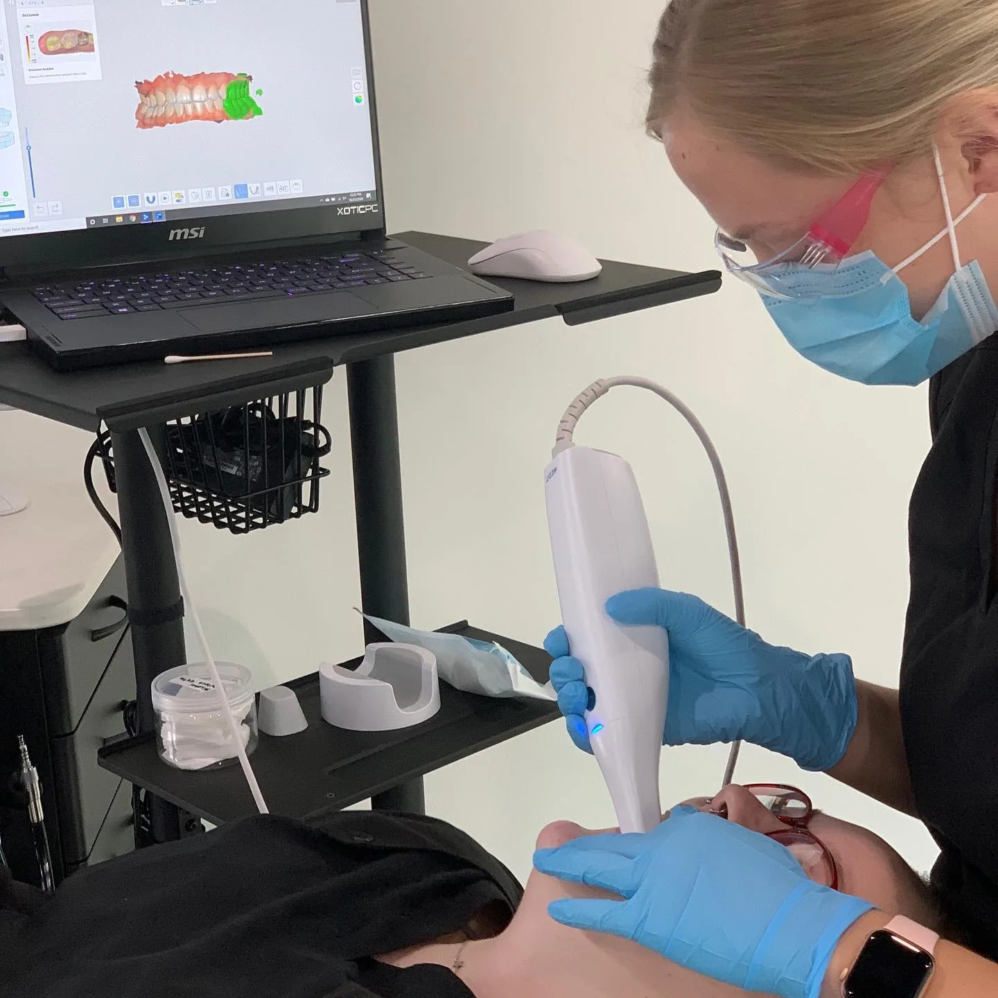 Intraoral Scanner Intraoral Scanner