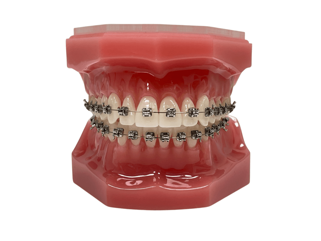 Ceramic Braces, Burnie, The Orthodontic Specialists, Devonport