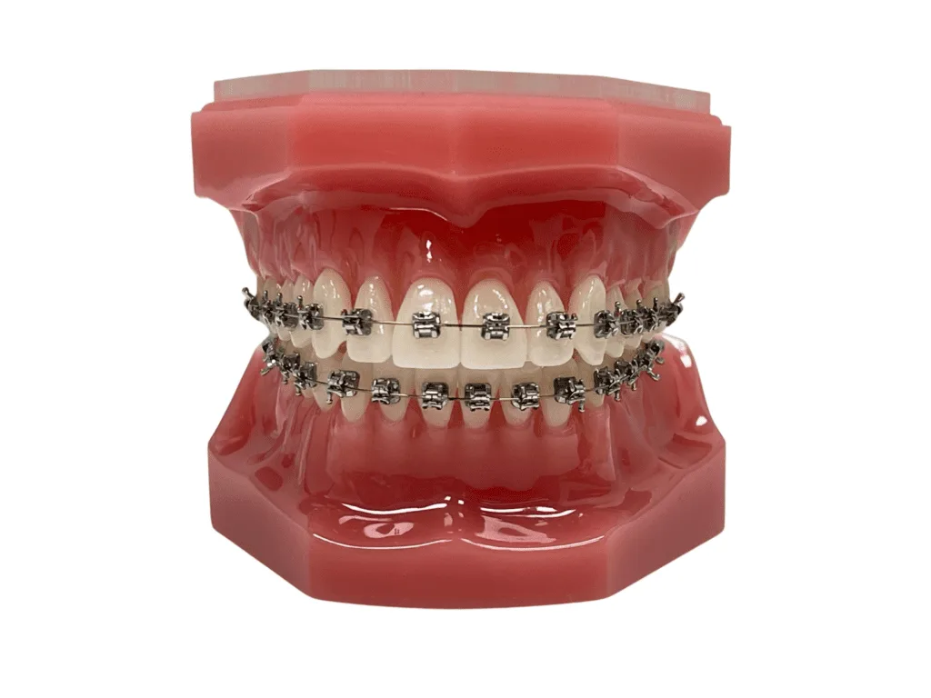 Metal Self-ligating Braces, orthodontic office