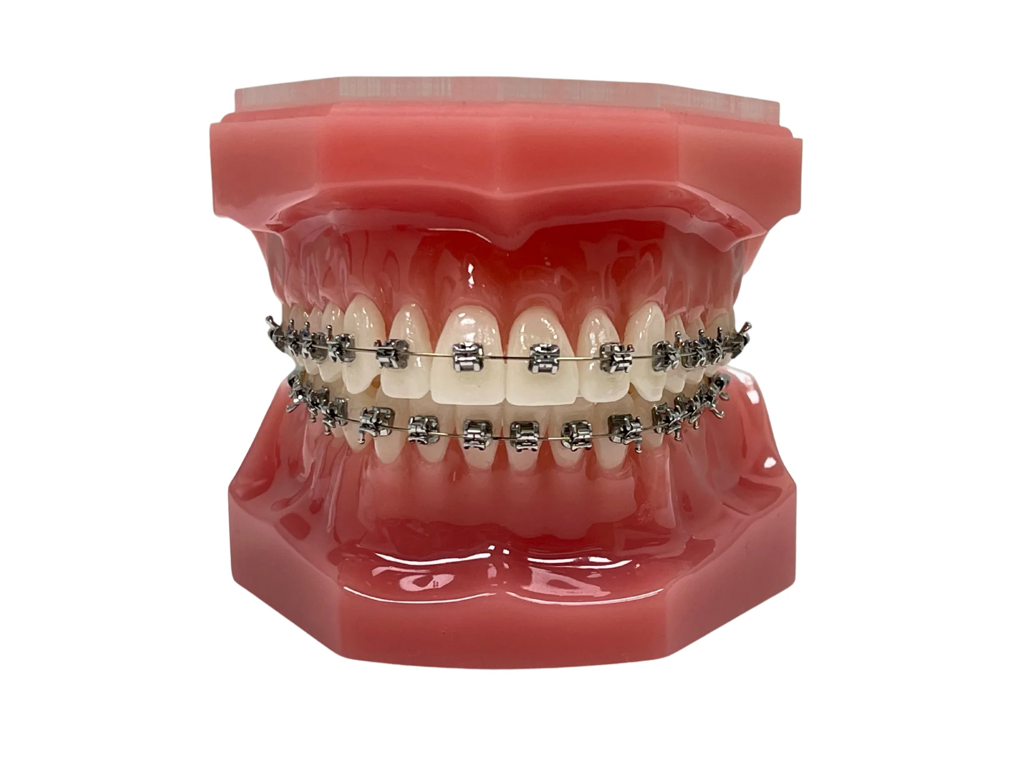 Metal Self-ligating Braces Metal Self-ligating Braces, orthodontic office