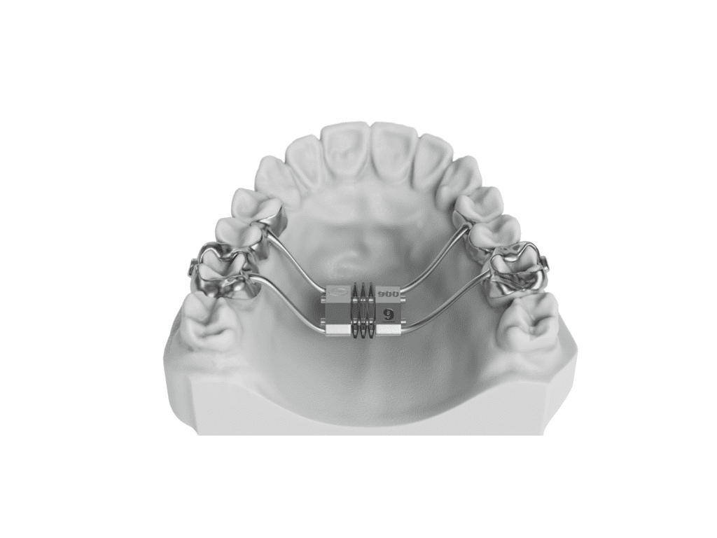 Leaf Spring Self Activated Expander, orthodontic expander.