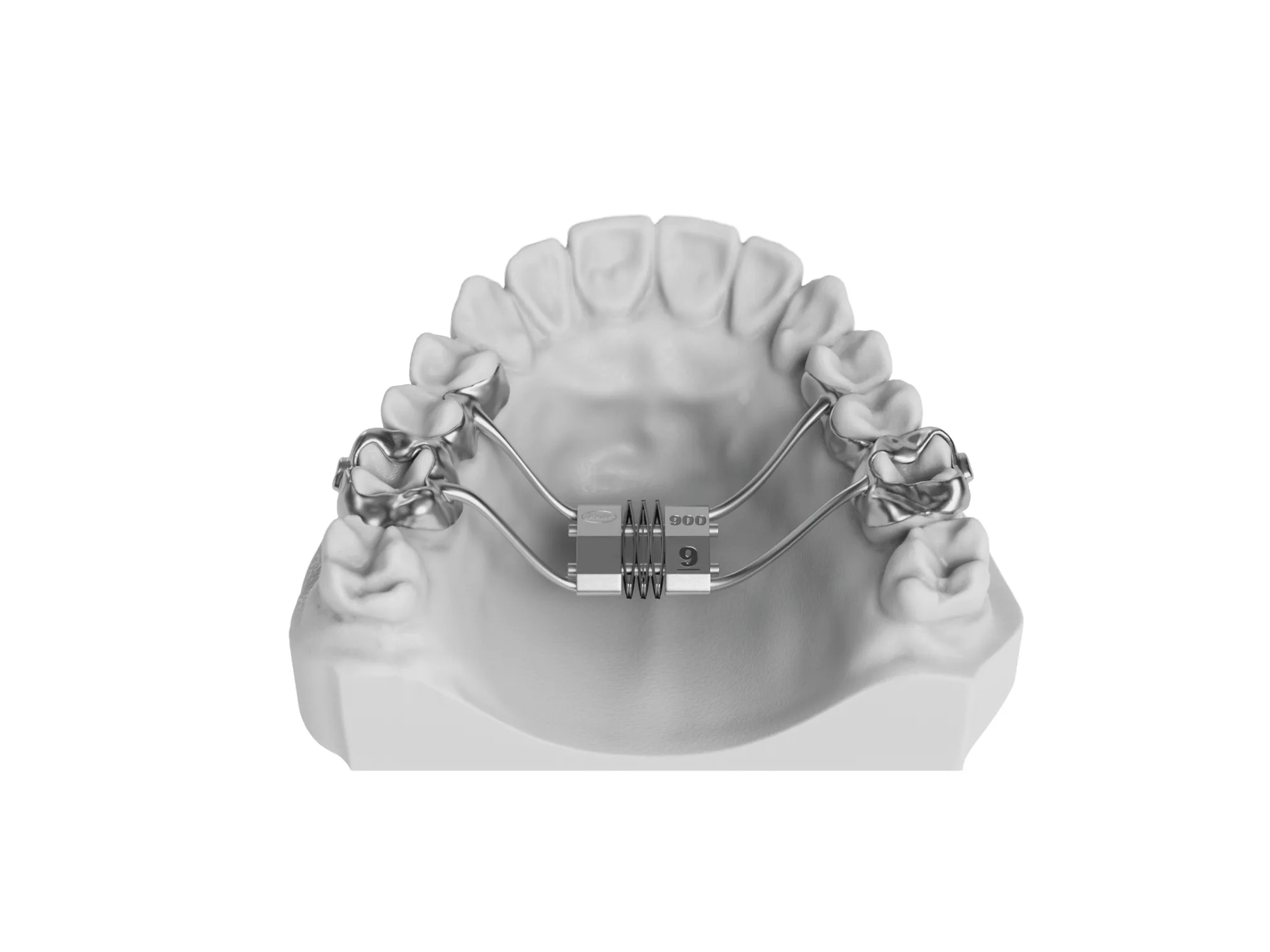 Leaf Spring Self Activated Expander Leaf Spring Self Activated Expander, orthodontic expander.