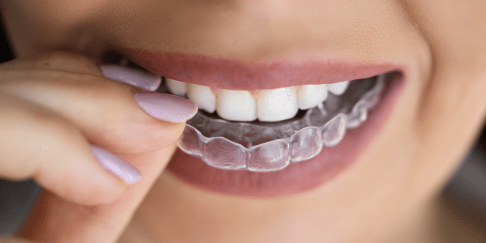 Dentista Invisalign Boss Orthodontics
