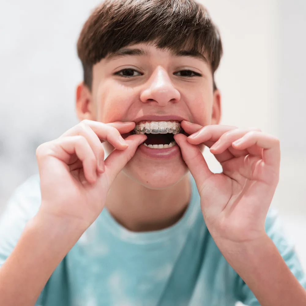 Boy with Clear Aligners Teen Boy Putting His Aligners In