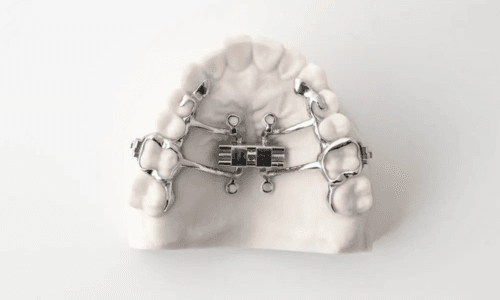 Adult orthodontic expander, MARPE, jaw expander for adults