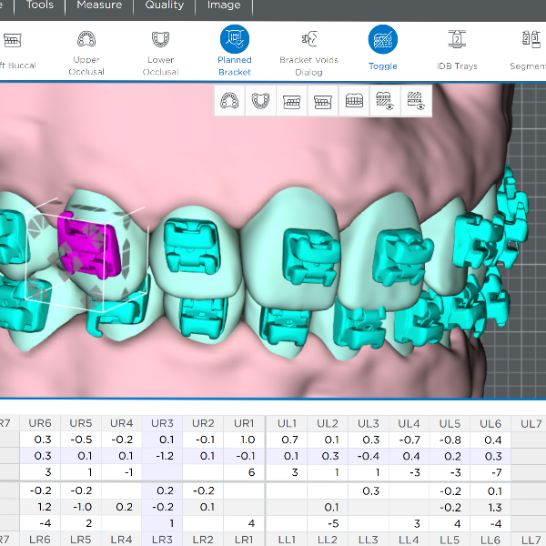 3d-render-of-custom-orthodontic-braces