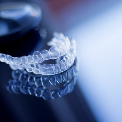 invisible-clear-aligners-dental-orthodontics